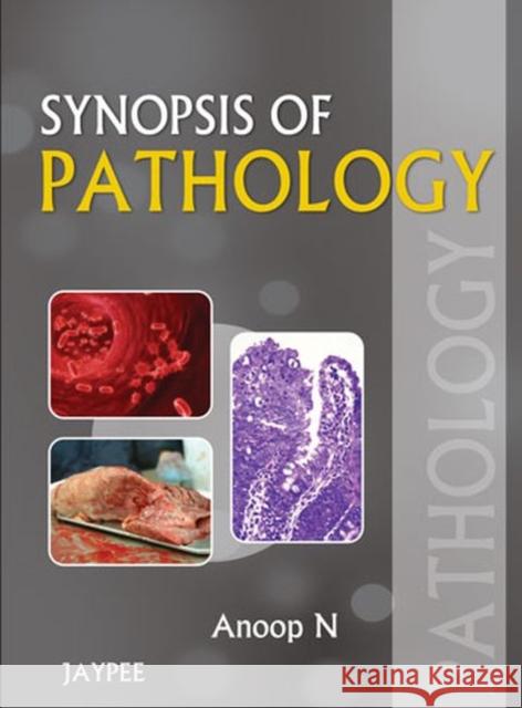 Synopsis of Pathology Anoop N 9789350904756 0