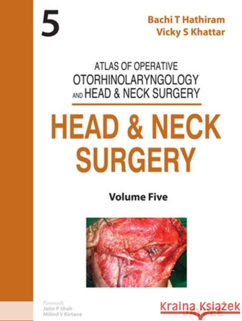 Atlas of Operative Otorhinolaryngology and Head & Neck Surgery: Head and Neck Surgery Bachi T Hathiram Vicky S. Khattar  9789350904831