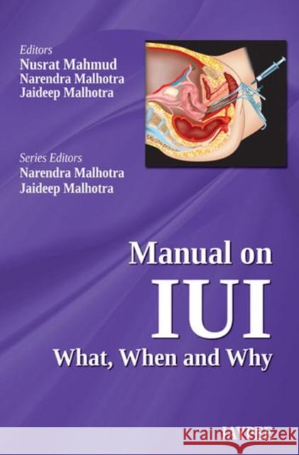 Manual on Iui: What, When and Why Mahmud, Nusrat 9789350904916 Jp Medical Ltd