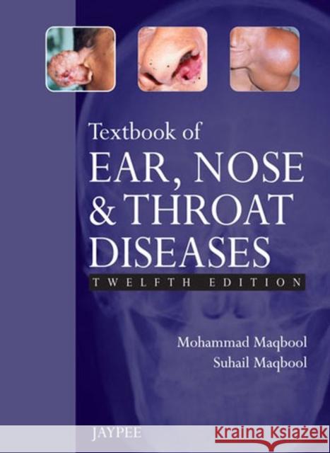 Textbook of Ear, Nose and Throat Diseases Mohammad Maqbool 9789350904954