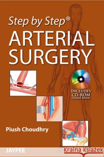 Step by Step: Arterial Surgery Piush Choudhry 9789350905104