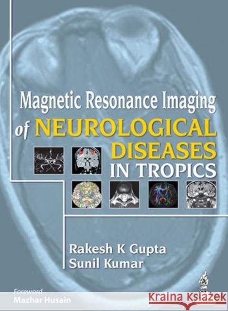 Magnetic Resonance Imaging of Neurological Diseases in Tropics Rakesh K. Gupta 9789350909720