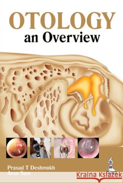 Otology: An Overview Deshmukh, Prasad T. 9789351520801