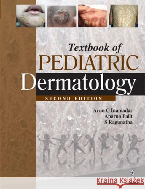 Textbook of Pediatric Dermatology Arun C. Inamadar Aparna Palit S. Ragunatha 9789351520832 Jaypee Brothers Medical Publishers