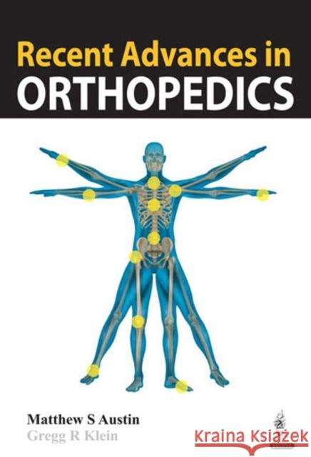 Recent Advances in Orthopedics Matthew S. Austin 9789351521129