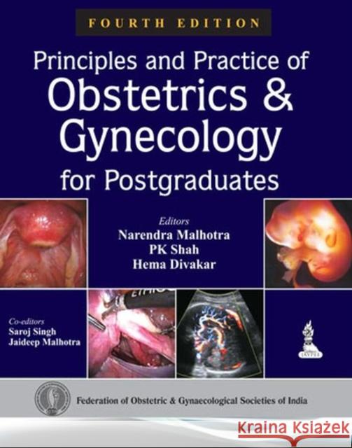 Principles and Practice of Obstetrics & Gynecology for Postgraduates Narendra Malhotra PK Shah Hema Divakar 9789351521631 Jaypee Brothers Medical Publishers