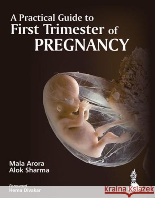 A Practical Guide to First Trimester of Pregnancy Mala Arora 9789351521785