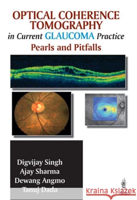 Optical Coherence Tomography in Current Glaucoma Practice: Pearls and Pitfalls Singh, Digvijay 9789351521884 Jp Medical Ltd