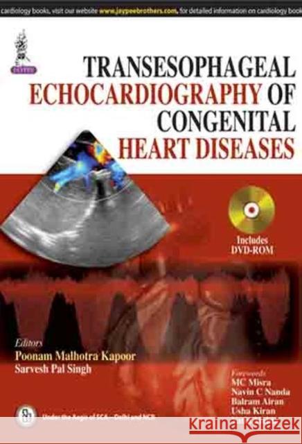 Transesophageal Echocardiography of Congenital Heart Diseases Poonam Malhotra Kapoor, Sarvesh Pal Singh 9789351522195