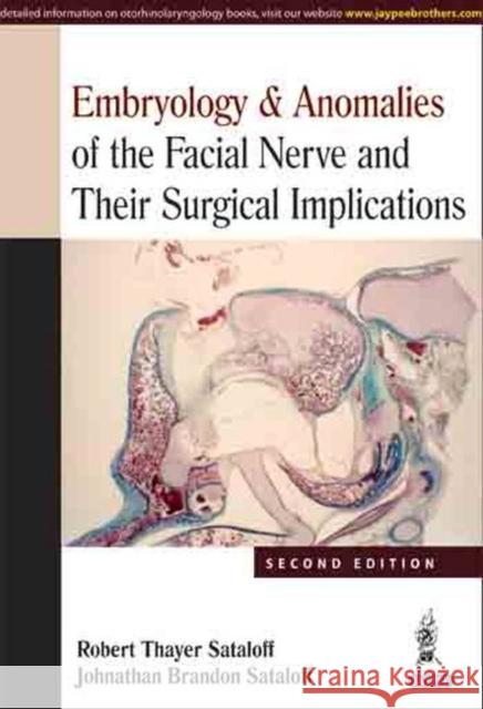 Embryology & Anomalies of the Facial Nerve and Their Surgica Robert Thayer Sataloff 9789351522409