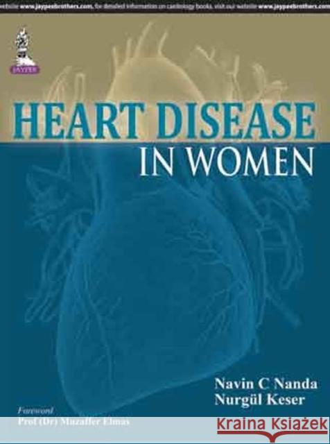 Heart Disease in Women  Nanda, Navin C.|||Keser, Nurgul 9789351522942