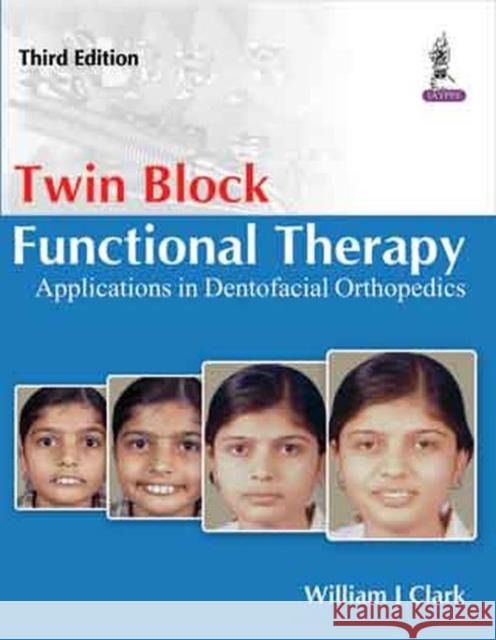 Twin Block Functional Therapy: Applications in Dentofacial Orthopaedics  Clark, William 9789351523147 