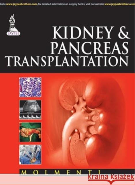 Kidney & Pancreas Transplantation  Molmenti, Ernesto Pompeo 9789351523390 