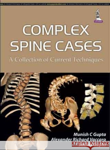 Complex Spine Cases: A Collection of Current Techniques  Gupta, Munish C.|||Gupta, Sachin|||Vaccaro, Alexander R. 9789351523864