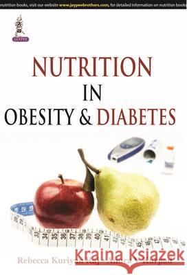 Nutrition in Obesity & Diabetes Anura V Kurpad   9789351524212 Jaypee Brothers Medical Publishers