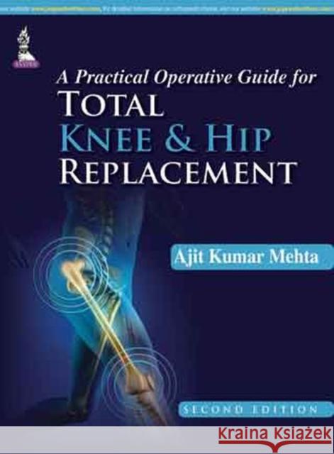 A Practical Operative Guide for Total Knee and Hip Replacement Ajit  Kumar Mehta   9789351524823 Jaypee Brothers Medical Publishers