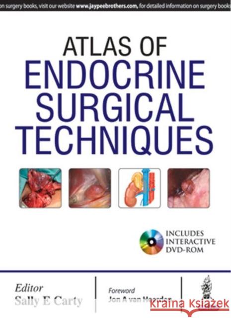 Atlas of Endocrine Surgical Techniques Sally E. Carty 9789351525295 Jaypee Brothers, Medical Publishers Pvt. Ltd.