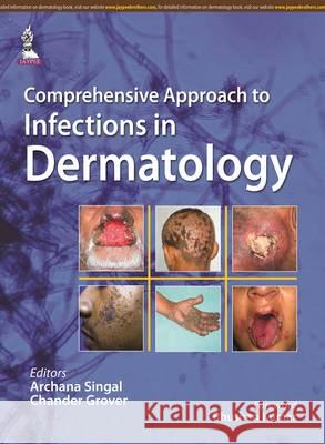 Comprehensive Approach to Infections in Dermatology Archana Singal, Chander Grover 9789351527480 Jaypee Brothers Medical Publishers