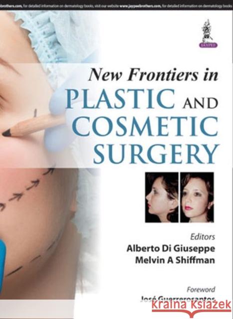 New Frontiers in Plastic and Cosmetic Surgery Alberto Di Giuseppe, Melvin A Shiffman 9789351527763 Jaypee Brothers Medical Publishers