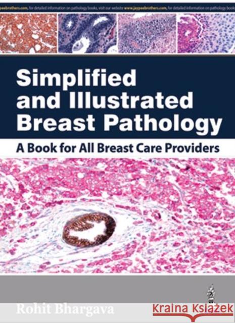 Simplified and Illustrated Breast Pathology  Bhargava, Rohit 9789351527787 