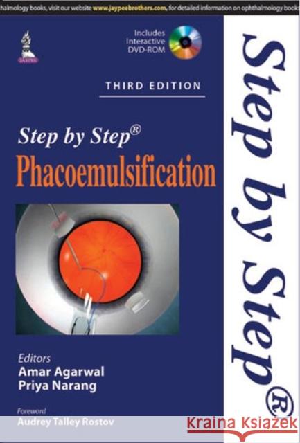 Step by Step Phacoemulsification   9789351527831 