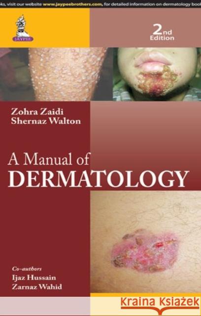 A Manual of Dermatology Zohra Zaidi Shernaz Walton  9789351527923