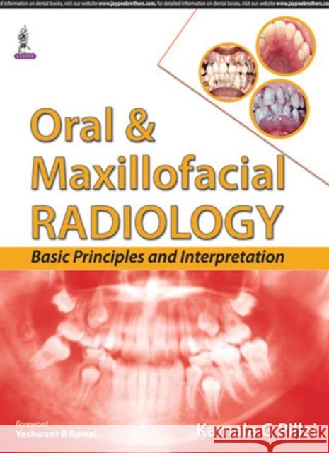 Oral & Maxillofacial Radiology Basic Principles and Interpretation Pillai, Kamala G. 9789351528548 