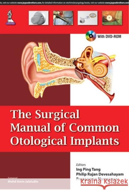 Surgical Manual of Common Otological Implants  Devesahayam, Philip Rajan|||Narayanan, Prepageran 9789351528586