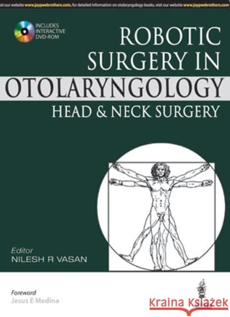 Robotic Surgery in Otolaryngology Head and Neck Surgery Nilesh R Vasan 9789351529019 Jaypee Brothers Medical Publishers