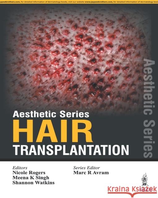 Aesthetic Series-Hair Transplantation Rogers, Nicole 9789351529323 Jaypee Brothers, Medical Publishers Pvt. Ltd.