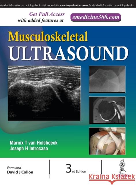 Musculoskeletal Ultrasound van Holsbeeck Marnix, Joseph Introcaso 9789351529330 Jaypee Brothers Medical Publishers