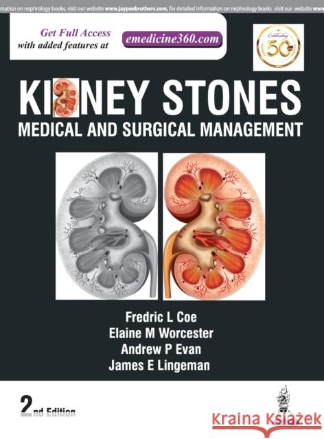 Kidney Stones Coe, Fredric L. 9789351529422 Jaypee Brothers, Medical Publishers Pvt. Ltd.