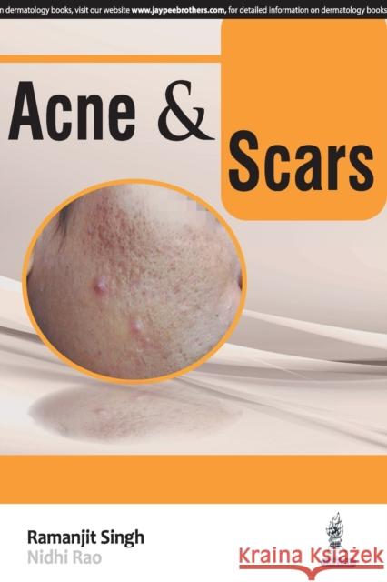 ACNE and SCARS Singh, Ramanjit 9789351529699