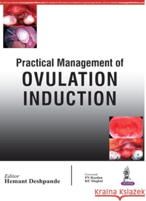 Practical Management of Ovulation Induction Hemant Deshpande 9789352500284 Jaypee Brothers, Medical Publishers Pvt. Ltd.