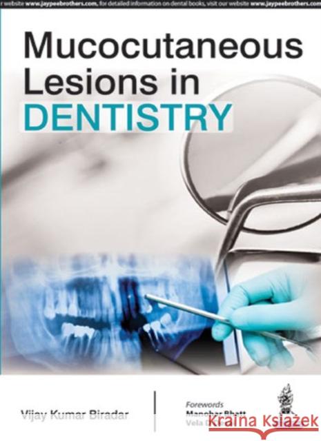 Mucocutaneous Lesions in Dentistry Vijay Kumar Biradar 9789352500406