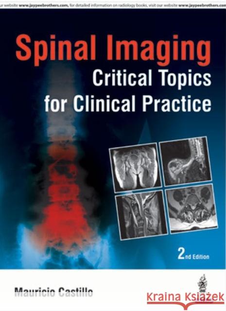 Spinal Imaging: Critical Topics for Clinical Practice Castillo, Mauricio 9789352501250