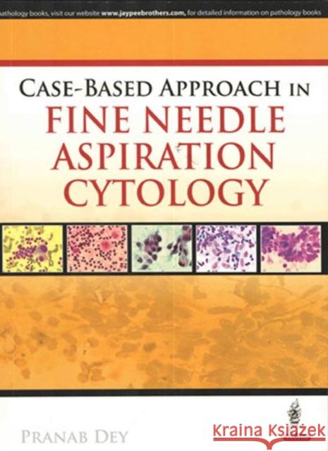 Case-Based Approach in Fine Needle Aspiration Cytology Pranab Dey 9789352501809 Jaypee Brothers, Medical Publishers Pvt. Ltd.