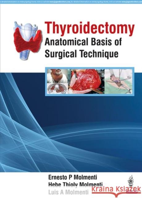 Thyroidectomy: Anatomical Basis of Surgical Technique Ernesto P. Molmenti 9789352700035 Jp Medical Ltd