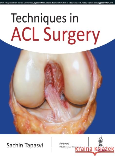 Techniques in ACL Surgery Sachin Tapasvi 9789352700363