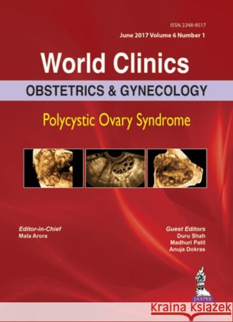 World Clinics: Obstetrics & Gynecology: Polycystic Ovary Syndrome: Volume 6, Number 1 Mala Arora 9789352700691