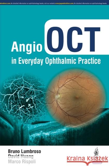 Angio Oct in Everyday Ophthalmic Practice Bruno Lumbroso 9789352700844 Jp Medical Ltd