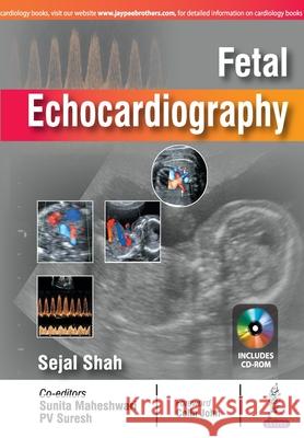 Fetal Echocardiography Sejal Shah 9789352701100