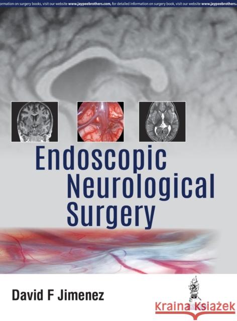 Endoscopic Neurological Surgery David F. Jimenez 9789352701223 Jp Medical Ltd