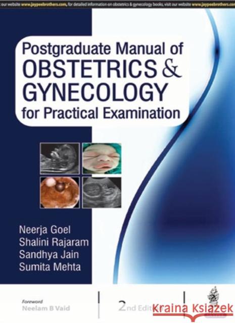 Postgraduate Manual of Obstetrics & Gynecology for Practical Examination Neerja Goel 9789352701742