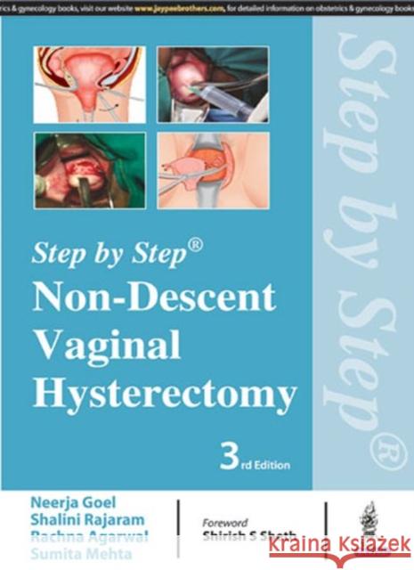 Step by Step: Non-Descent Vaginal Hysterectomy Neerja Goel 9789352701759