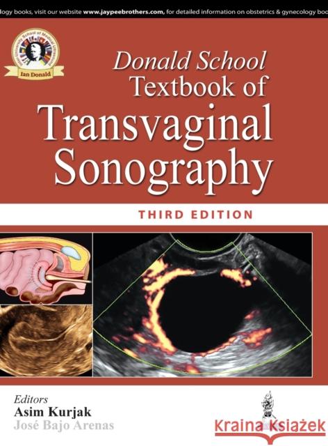Donald School Textbook of Transvaginal Sonography Asim Kurjak 9789352701971 Jp Medical Ltd