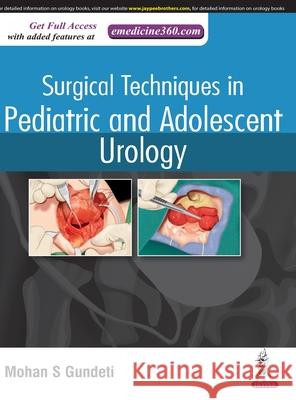 Surgical Techniques in Pediatric and Adolescent Urology Mohan S. Gundeti   9789352702046