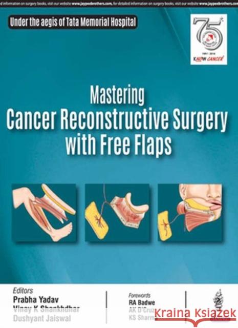 Mastering Cancer Reconstructive Surgery with Free Flaps Prabha Yadav 9789352702053