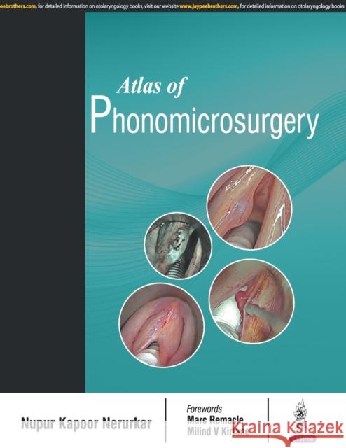 Atlas of Phonomicrosurgery Nupur Kapoor Nerurkar   9789352702244