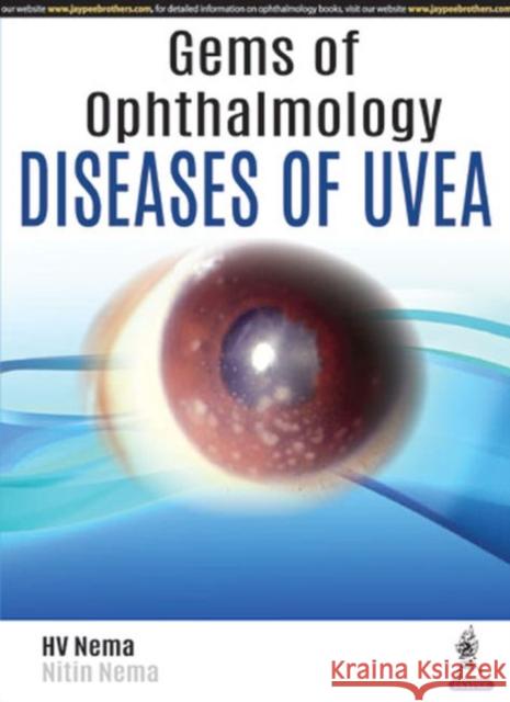 Gems of Ophthalmology: Diseases of Uvea Nema, Hv 9789352702725